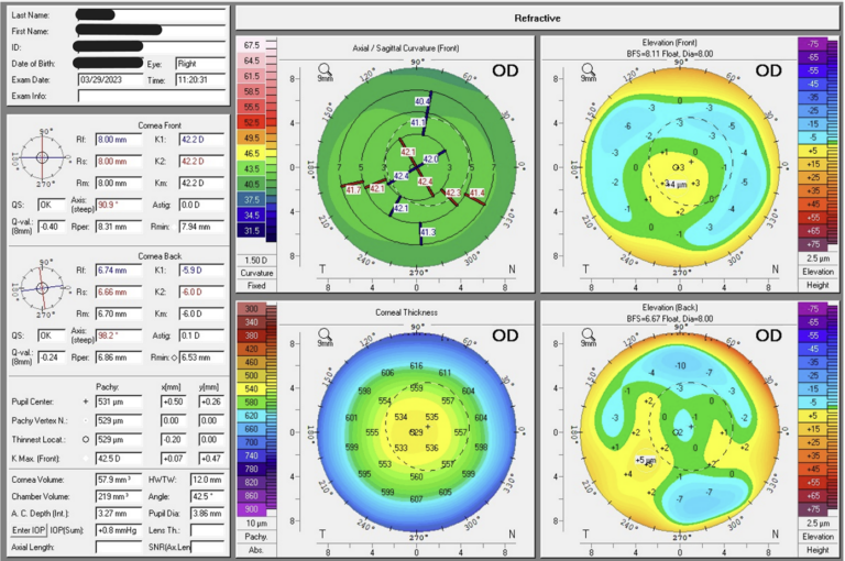 Laser 247: Revolutionizing Laser Cutting Services for Modern Manufacturing